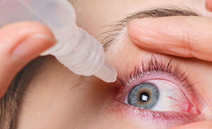 Ocular Surface Diseases