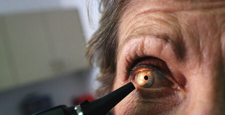 best cataract surgeon in Delhi