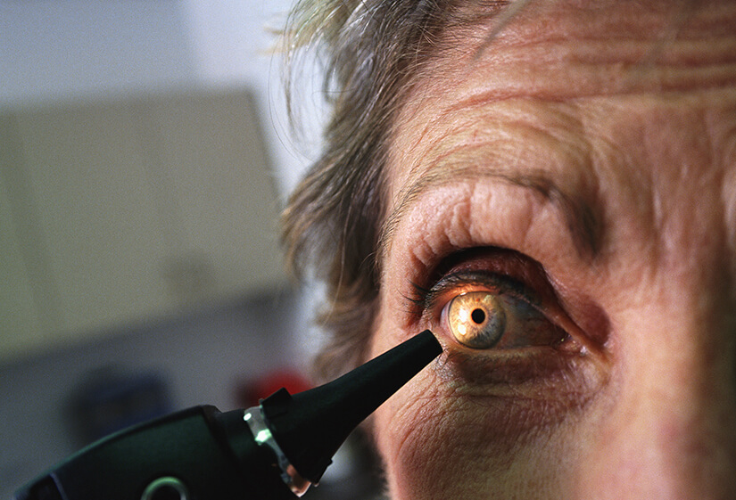 best cataract surgeon in Delhi