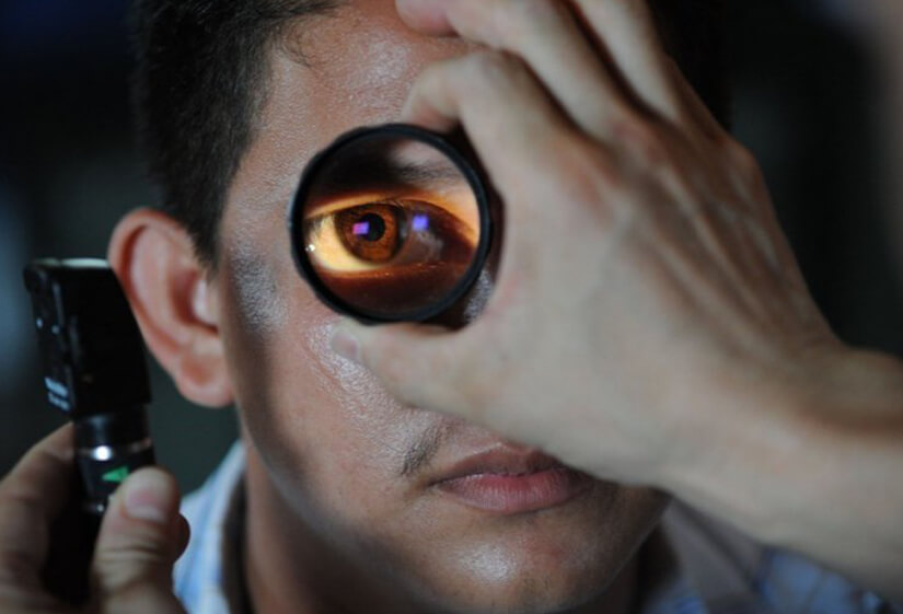 best eye specialist in Delhi