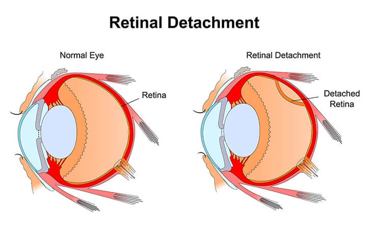 best eye specialist in Delhi