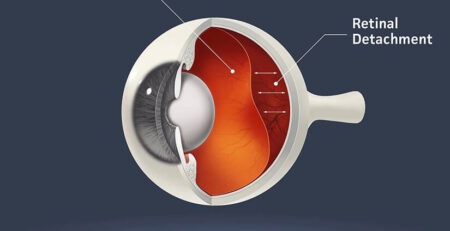 best eye specialist in Delhi