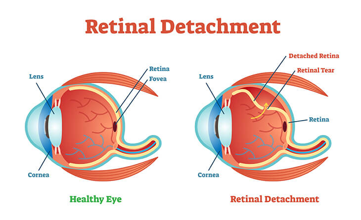 best eye specialist in Delhi