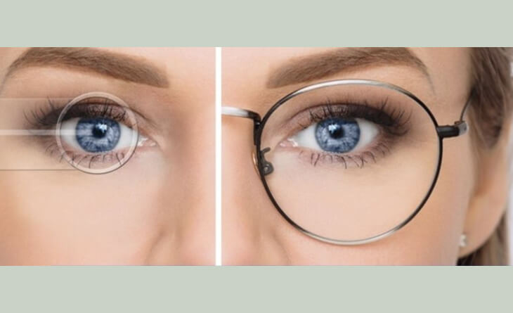 Refractive Surgery