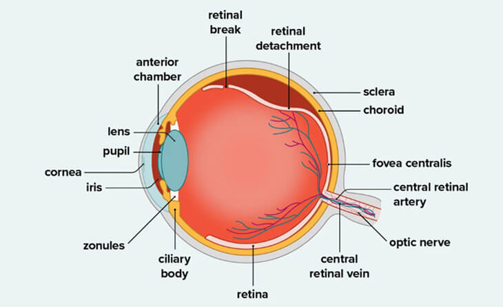 retinal detachment surgery