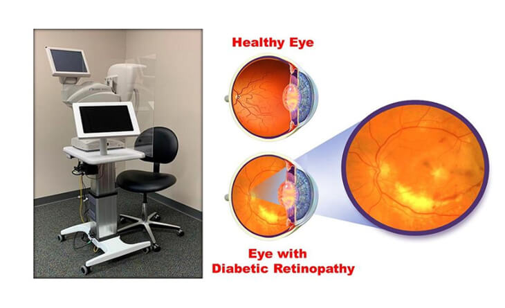 Diabetic retinopathy treatment