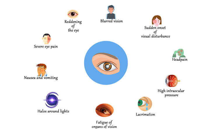 Glaucoma Treatment