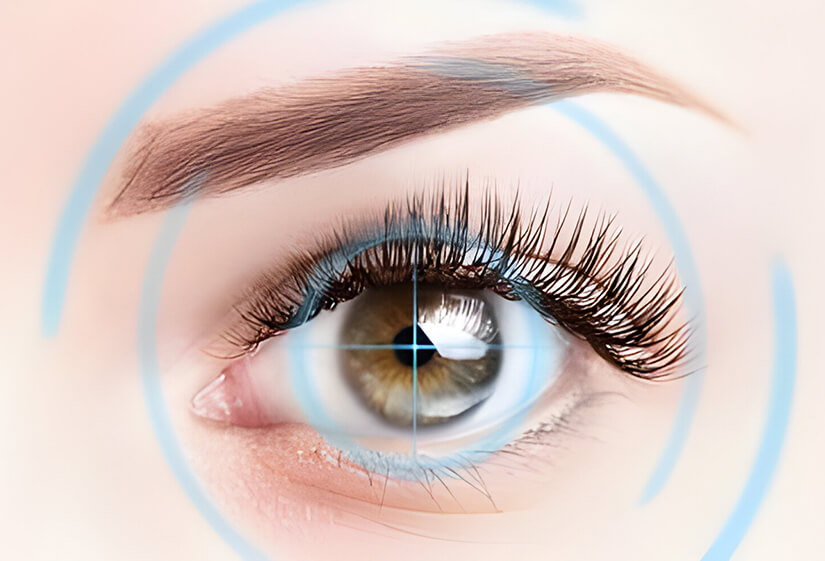 refractive errors treatment