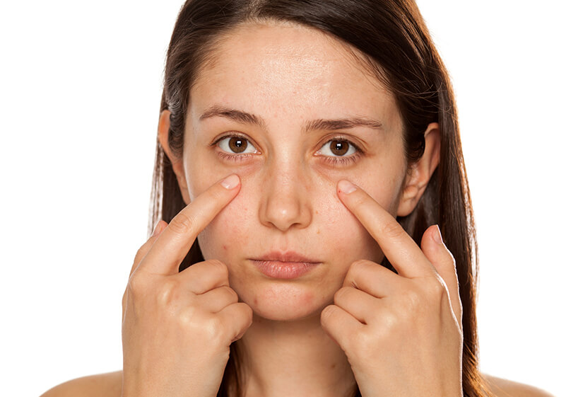 Dark circles removal