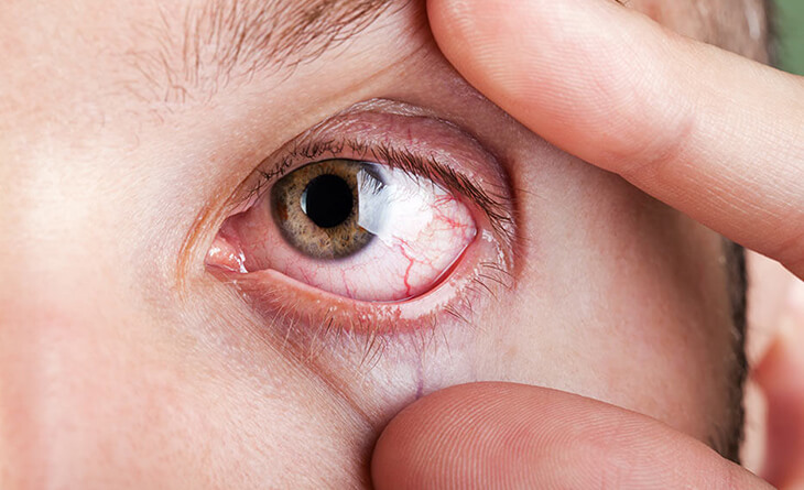 Why Your Vision Blurs After Too Much Screen Time And How to Fix It- Dr Rajat Gupta - Plastic Surgeon in Delhi -02 Screen time for eyes