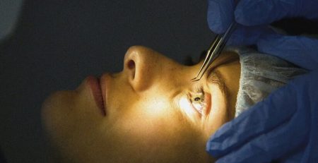 Laser eye surgery cost