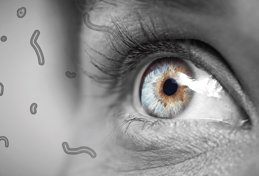 floaters eye treatment