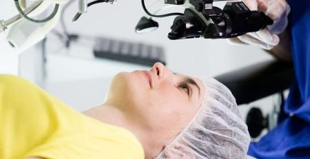 lasik surgery