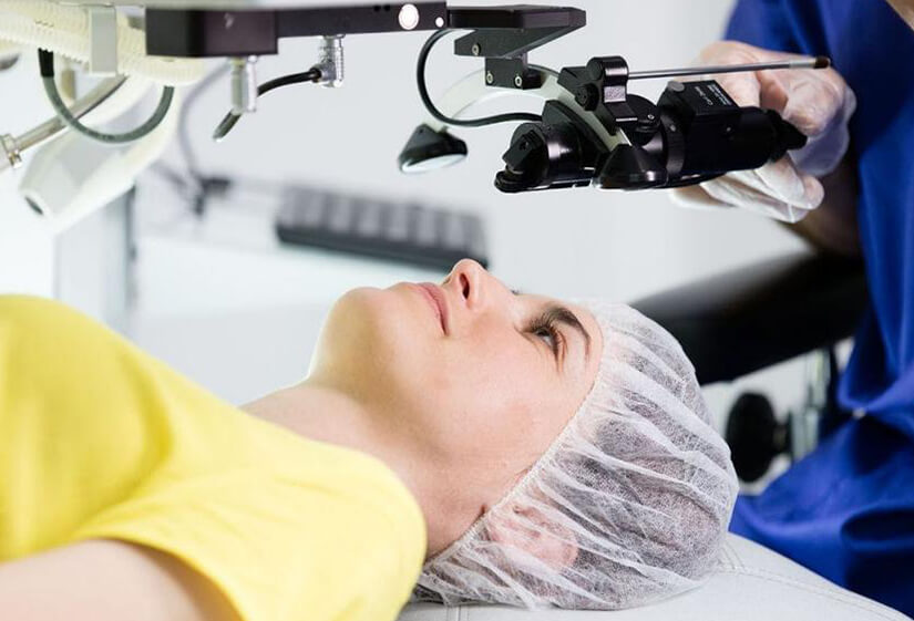 lasik surgery