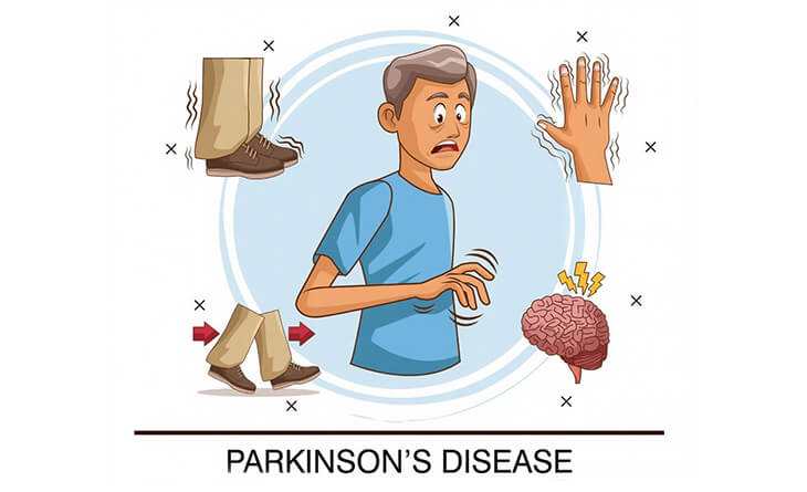 Can a Parkinsons Patient Have Cataract Surgery - Dr Anisha Gupta - Eye Treatment Parkinson’s disease treatments